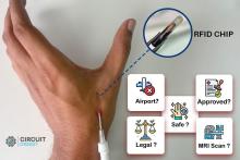 RFID Chip Implant