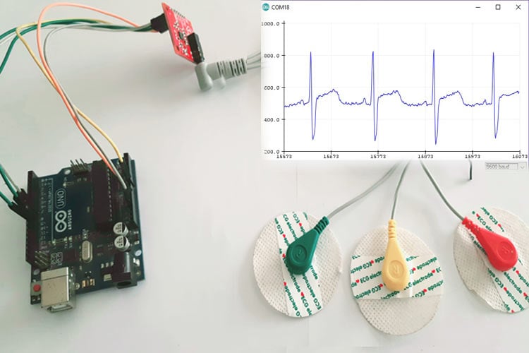 AD8232 ECG sensor with Arduino AD8232 ECG sensor with Arduino